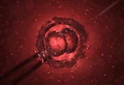 Obama Dilarang Mendanai Riset Embrio Manusia