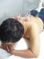  Hukum Bekam Saat Puasa Ramadan