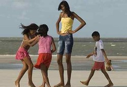 Gadis ABG Menjulang bak Tiang Listrik Karena Gigantisme 