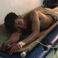 Tak Kunjung Sembuh, Penumpang Kapal Dorolonda Berusaha Bunuh Diri