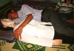 Gangguan Mental Tidur dengan Mayat