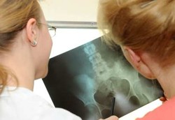 Teknik Mengeluarkan Ginjal Melalui Vagina