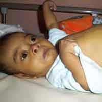 Yusuf, Bayi Penderita Kelainan Hati Meninggal Dunia