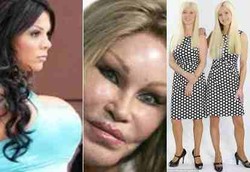 4 Operasi Bedah Plastik Paling Fenomenal