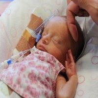 Ditinggal Mati Orangtua, Bayi Prematur Menghembuskan Nafas Terakhir