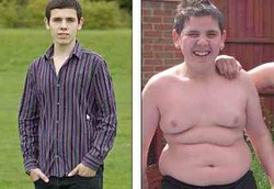 Wanita Tergemuk Beri Anak Warisan Berupa Operasi Lambung