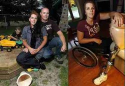 Sembuh dari Kanker Setelah Kehilangan Separuh Badan 