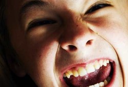 Zat Pewarna Makanan Sintetik Bikin Anak Hiperaktif