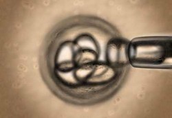 Dapatkah Sel Punca Dipakai untuk Kloning Manusia?