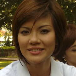 Nggak Pede, Aline Adita Putihkan Gigi