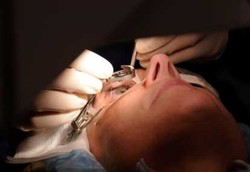 10 Fakta Tentang Lasik Mata