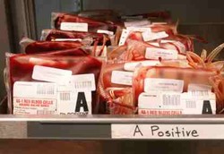 Kenapa Ada 4 Jenis Golongan Darah?