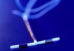 Dengan KB Spiral Penderita Kanker Rahim Bisa Punya Anak 