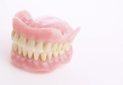 4 Jenis Pemasangan Gigi Palsu