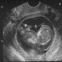 Anak Zaman Sekarang Eksis di Internet Sejak Dalam Rahim