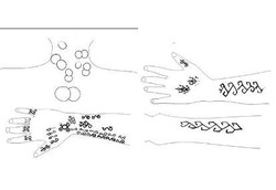 Mumi Kuno Asal Peru Sudah Mengenal Akupunktur