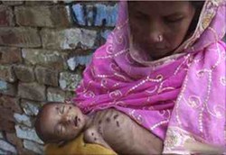 1 Miliar Orang Masih Kelaparan, RI Masuk Kategori Serius