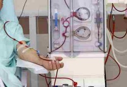 Cuci Darah dan Caesar Paling Sering Ditanggung Jamkesmas 