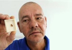 Ooo, Ada Gigi Tumbuh di Telinga