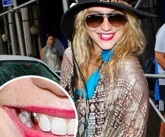 Ingin Tampil Mewah, Kesha Pakai Gigi Emas