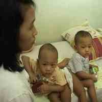 Hasil MRI, Rahman-Rohim Hanya Miliki Satu Penis