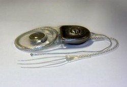 Pertama di Dunia: Penangkal Vertigo Ditanam di Kepala