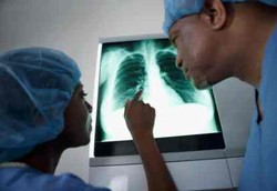 Paru-paru Bisa Merasakan Pahit 