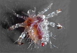 Rambut Kemaluan Juga Ada Kutunya