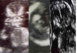 Gambar-gambar Aneh dalam Foto USG 