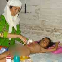 Nurhidayah Menahan Sakit dan Malu Karena Tak Punya Anus