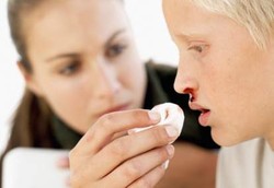 Saat Mimisan Jangan Menengadahkan Kepala