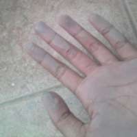 Abu Vulkanik yang Kena Mata Bisa Timbulkan Pedih