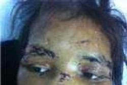 PKB: Langgar HAM, Majikan Sumiati Harus Dihukum Qishas