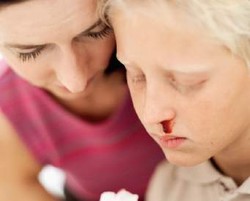 Penyebab & Cara Mengatasi Mimisan Pada Anak