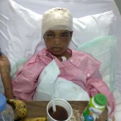 Operasi Sumiati Akan Dilanjutkan ke Hidung & Bibir