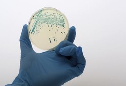 Bakteri E.Coli Bisa Jadi Antibiotik
