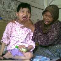 Duh, Gadis Berusia 17 Tahun Hanya Berbobot 19 Kg