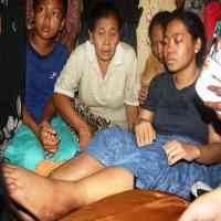 TKW Asal Situbondo Cacat Akibat Disiksa Majikan di Arab Saudi 