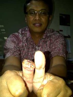 BLU TransJ Urus Asuransi Penumpang Yang Kehilangan Jempol di Bus