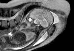 Pertama di Dunia Melahirkan di Dalam Mesin Scan
