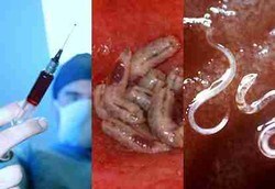 Pengobatan Alternatif yang Manjur Tapi Seram