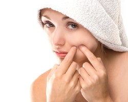 Cegah Jerawat dengan Hindari 4 Makanan Berikut Ini!