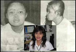 Ketekunan Tiara Melawan Lupus