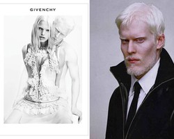 Model Albino Dalam Iklan Terbaru Givenchy