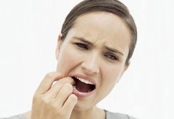 Mengatasi Gusi yang Sering Berdarah