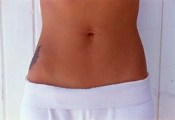 Cara Jitu Membersihkan Udel