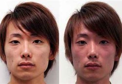 Wajah Memerah Saat Minum Alkohol Mudah Kena Kanker