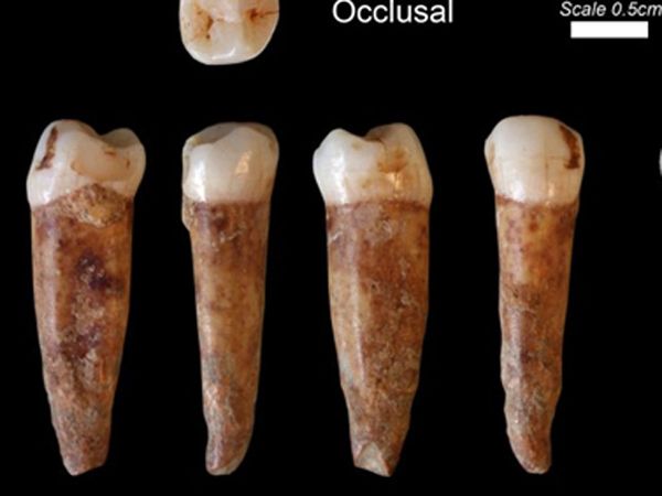 Gigi Berusia 400 ribu Tahun 