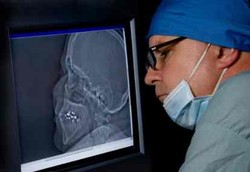 Otak Manusia Menyusut Dalam 20 Ribu Tahun Terakhir 