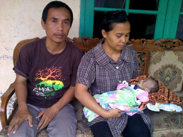 Pasca Operasi, Bayi 3 Bulan Kondisinya Memburuk 